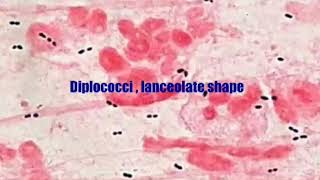 Gram stain of pneumococcus [upl. by Atalie472]