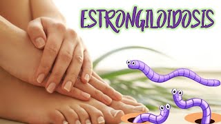 Estrongiloidosis el Parásito que entra por la Piel [upl. by Boarer585]