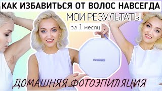 УДАЛЕНИЕ ВОЛОС НАВСЕГДА ДОМА МОИ РЕЗУЛЬТАТЫ через МЕСЯЦ  ФОТОЭПИЛЯТОР ILUMINAGE Precise Touch Pro [upl. by Furie]