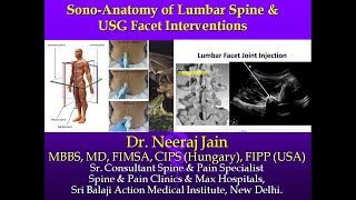 ULTRASOUND ANATOMY OF LUMBAR SPINE amp USG FACET INTERVENTION Dr Neeraj Jain MBBS MD CIPS FIPP USA [upl. by Ttirrej]