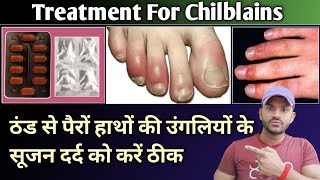 treatment for chilblains ठंड से पैरों हाथों के सूजन दर्द को करें ठीक [upl. by Ahsied513]