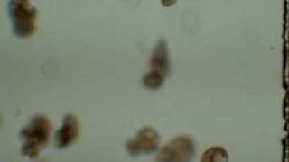 Rotifer a type of live feed for marble goby larvae for 2 to 12 day old [upl. by Dumas]