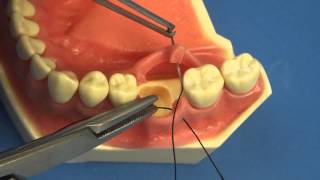 LEARN TO SUTURE THE EASY WAY  Surgical Technique  Interrupted Buccal Suturing  Dental  Medical [upl. by Schramke]