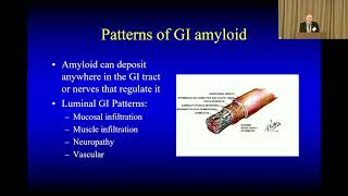 ATTR Amyloidosis amp the Gut GI Symptoms amp Treatments [upl. by Dare708]