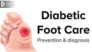 Diabetic Foot Care  Prevention and Diagnosis  Dr Mohan M R [upl. by Ameen388]