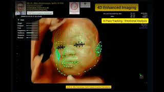 4D AI Integrated Emotional Facial Tracking Ultrasound [upl. by Chad]