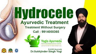 Hydrocele Ayurvedic Treatment in Hindi  हाइड्रोसील अंडकोष  ठीक करें बिना सर्जरी के  DR Yogi [upl. by Levan]