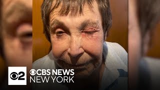 89yearold woman randomly attacked in NYC [upl. by Lytsirk]