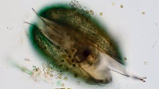 Inside a Freshwater Ostracod [upl. by Htnicayh]