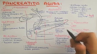 Pancreatitis causas fisiopatología clínica diagnóstico y tratamiento [upl. by Marielle]