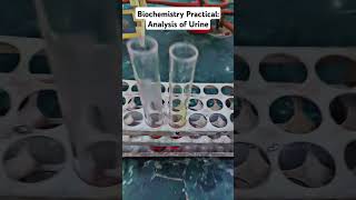 Biochemistry Practical Analysis of Urine for Urea and Creatinine in MBBS medico mbbs shorts [upl. by Asirralc]