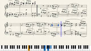 Beethoven 33 Variations on a waltz by Anton Diabelli Diabelli VariationsPiano Tutorial  Sheet [upl. by Queen]