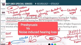 presbycusis Vs noise induced hearing loss otorhinolaryngology 4  First Aid USMLE Step 1 in Urdu [upl. by Eldin]