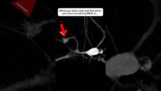 Brain cell restructures itself after forming a new connection neuroplasticity neuroscience brain [upl. by Simetra]