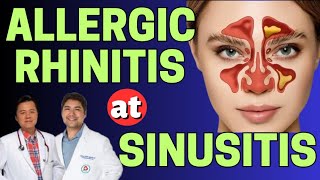 Allergic Rhinitis at Sinusitis  Payo ni Doc Gim Dimaguila ENT Doctor at Doc Willie Ong [upl. by Anaes]