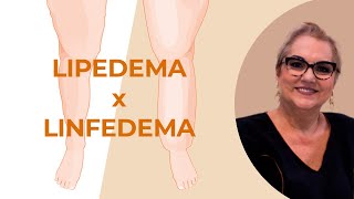 Linfedema e Lipedema [upl. by Jehiel]