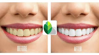 HOW TO MAKE TEETH WHITENING IN SNAPSEED PHOTO EDITING YOUSSEFWAEL [upl. by Conal]