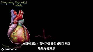 협심증 치료 사례Case study of angina treatment with 治療心絞痛的案例研究Nghiên cứu trường hợp điều trị đau thắt [upl. by Connelly691]