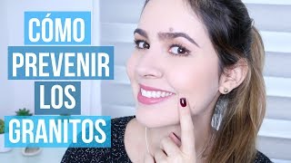 TIPS PARA PREVENIR⎜EVITAR EL ACNÉ Y LOS GRANITOS [upl. by Siloum]