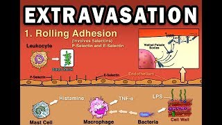 EXTRAVASATION [upl. by Sayres198]