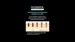 PROCEDIMIENTOS DE ENDODONCIA REGENERATIVA REP [upl. by Rufus339]