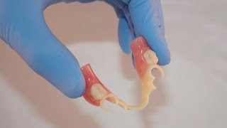 Bredent BioDentaplast Partial Dentures [upl. by Mairhpe]