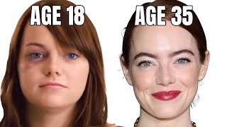 Emma Stones Incredible Plastic Surgery Transformation [upl. by Engel798]