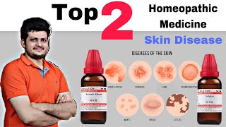 Top 2 Homeopathic Medicine for Skin  चर्म रोग की सबसे बेहतरीन दो होम्योपैथिक दवा [upl. by Anital]