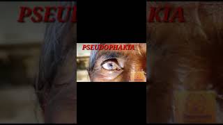 Pseudophakia l Ophthalmology l Medicine l Crazy medz l shorts [upl. by Assyram]