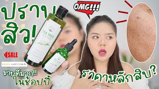 รีวิวสกินแคร์ สิว ที่ฮิตมาก ราคาหลักสิบหลักร้อย Naturista ผลลัพท์ดีมั้ย [upl. by Pliske]