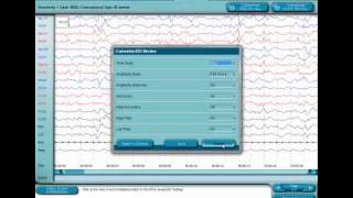 Brain Monitoring Normal Neonatal EEG with Dr Robert Clancy [upl. by Meit]