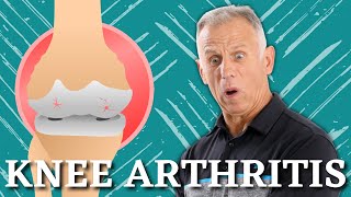 5 Proven Exercises for Knee Osteoarthritis or Knee Pain Do it Yourself [upl. by Meekyh]