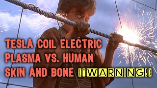 Electrocution Warning 10000 Volts vs Human Flesh and Bone [upl. by Mehala]