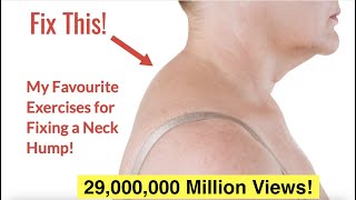 How to Fix a Neck Hump at Home FAST  With FREE Exercise Sheet [upl. by Osy]