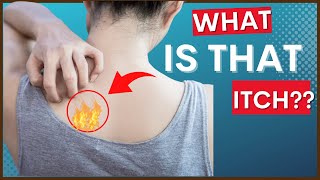 Notalgia Paresthetica “Itchy Back” amp Causes Symptoms amp Tips For Treatment [upl. by Anerb]