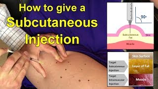 How to Give a Subcutaneous Injection Video [upl. by Laura541]