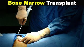 How Does Bone Marrow Transplant Works UrduHindi [upl. by Ikaz32]