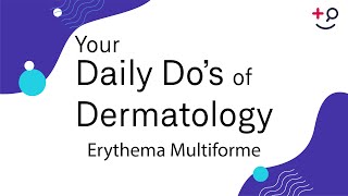 Erythema Multiforme  Daily Dos of Dermatology [upl. by Lucic]