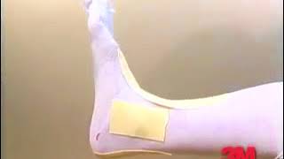 How to Apply and Remove Soft Cast Ankle Wrap StepbyStep [upl. by Lirpa]