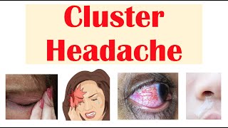 Cluster Headaches  Risk Factors Triggers Signs amp Symptoms Diagnosis Treatment [upl. by Ylas]