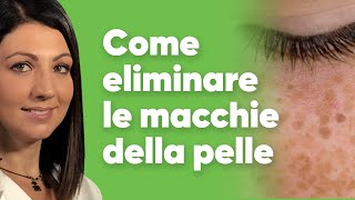 Come eliminare le macchie della pelle [upl. by Devy49]