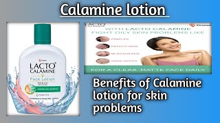 CALAMINE LOTION USES IN HINDI [upl. by Lleuqram]