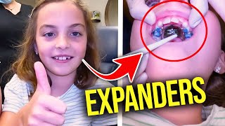 Getting a Palatal ExpanderHow expanders work  McKinney Orthodontist [upl. by Aronle]