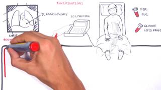 Acute Coronary Syndrome DETAILED Overview MI STEMI NSTEMI [upl. by Loredana486]