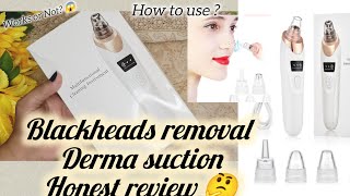 Blackheads removal pore cleaner device Honest Review 😱 blackheadremoval reviews [upl. by Gausman681]