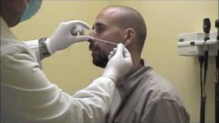 Procedure for Nasopharyngeal Swabs and Aspirates [upl. by Sessilu]