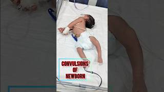 Convulsions Of Newly Bron Baby  ytshorts shorts youtubeshorts trending viralvideo cute [upl. by Corder]