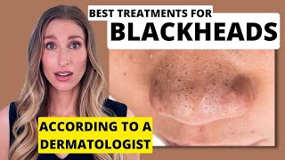 Blackheads Dermatologist Shares Best Treatments to Remove Them with Affordable Skincare Options [upl. by Wollis730]