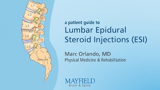 Lumbar Epidural Steroid Injections [upl. by Aticnemrac]