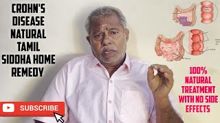 Crohns disease treatment in tamil  Best natural home remedy for crohns disease  Marunthu Venduma [upl. by Ellenwahs]